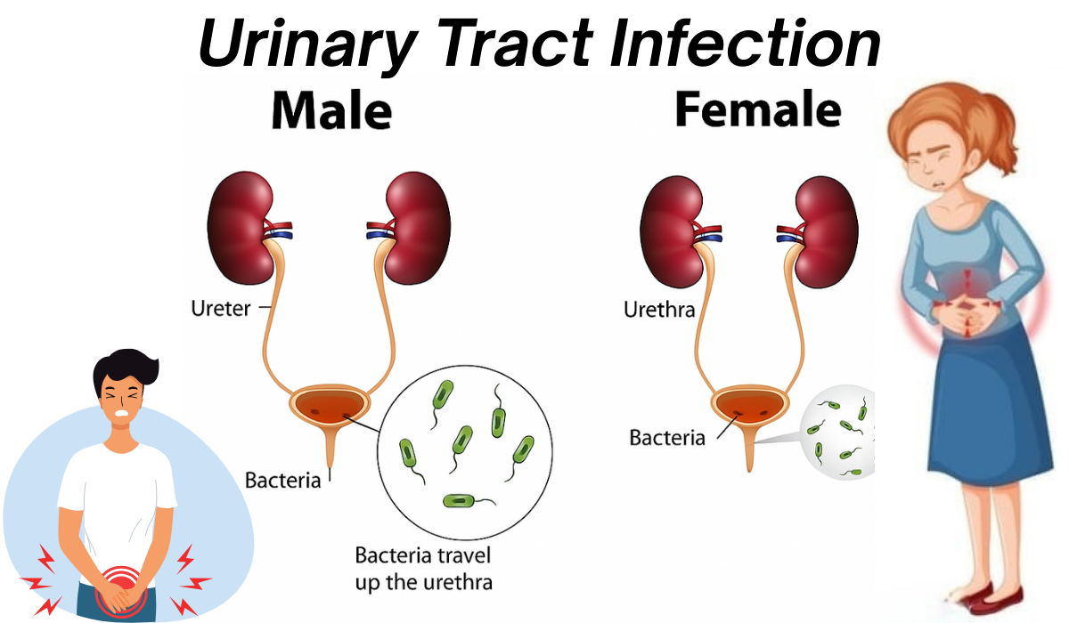 UTI (Urinary Tract Infection) ignored today Kidney damage tomorrow